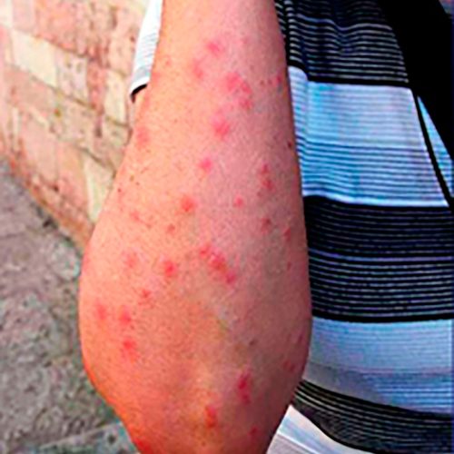 disinfestazione-05 (1)